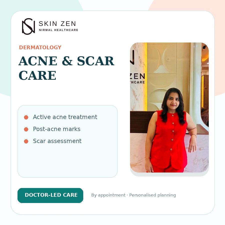Acne treatment